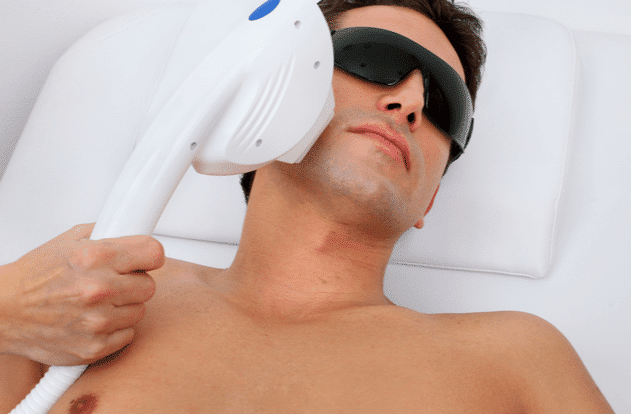 Common Areas Men Opt for Laser Hair Removal in Houston